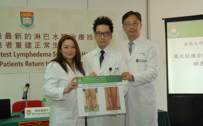 (From left) Dr Ava Kwong, Clinical Associate Professor of Department of Surgery, Li Ka Shing Faculty of Medicine, HKU; Dr Lawrence Liu Hin-lun, Associate Consultant of Department of Surgery, Tung Wah Hospital, and Honorary Clinical Assistant Professor of Department of Surgery, Li Ka Shing Faculty of Medicine, HKU; and Dr Chan Yu-wai, Clinical Associate Professor of Department of Surgery, Li Ka Shing Faculty of Medicine, HKU.
